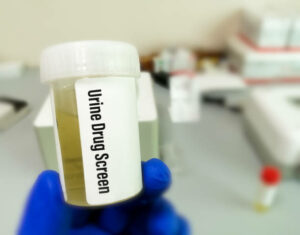How Long Will Drugs Show In A Urine Test? DATOS