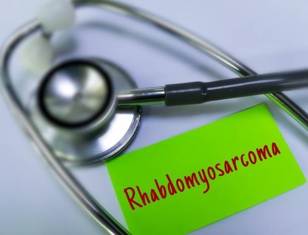 What Is RMS Disease (Rhabdomyosarcoma)? - DATOS